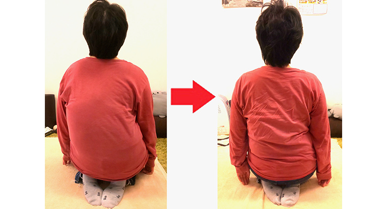 ビフォーアフター