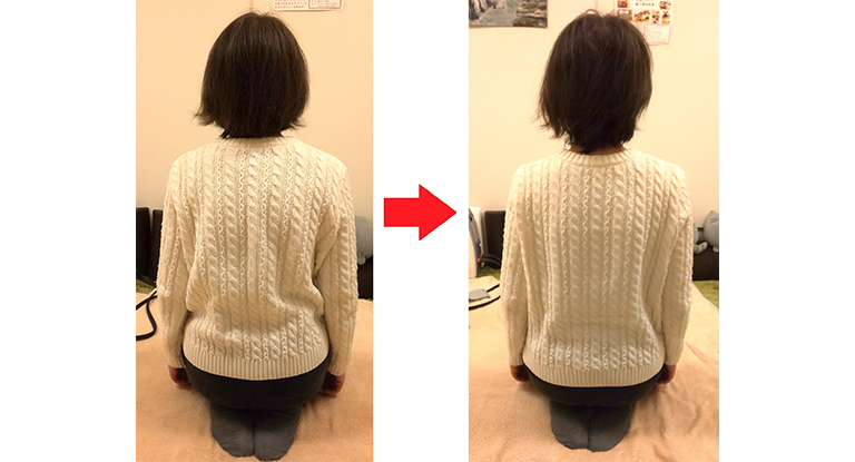 ビフォーアフター